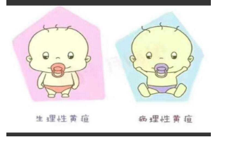 母乳性黄疸怎么办(宝宝吃母乳性黄疸怎么办)