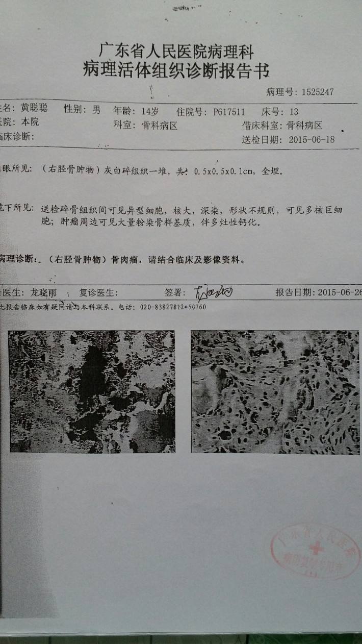 癌症晚期怎么办(八十岁老人癌症晚期怎么办)