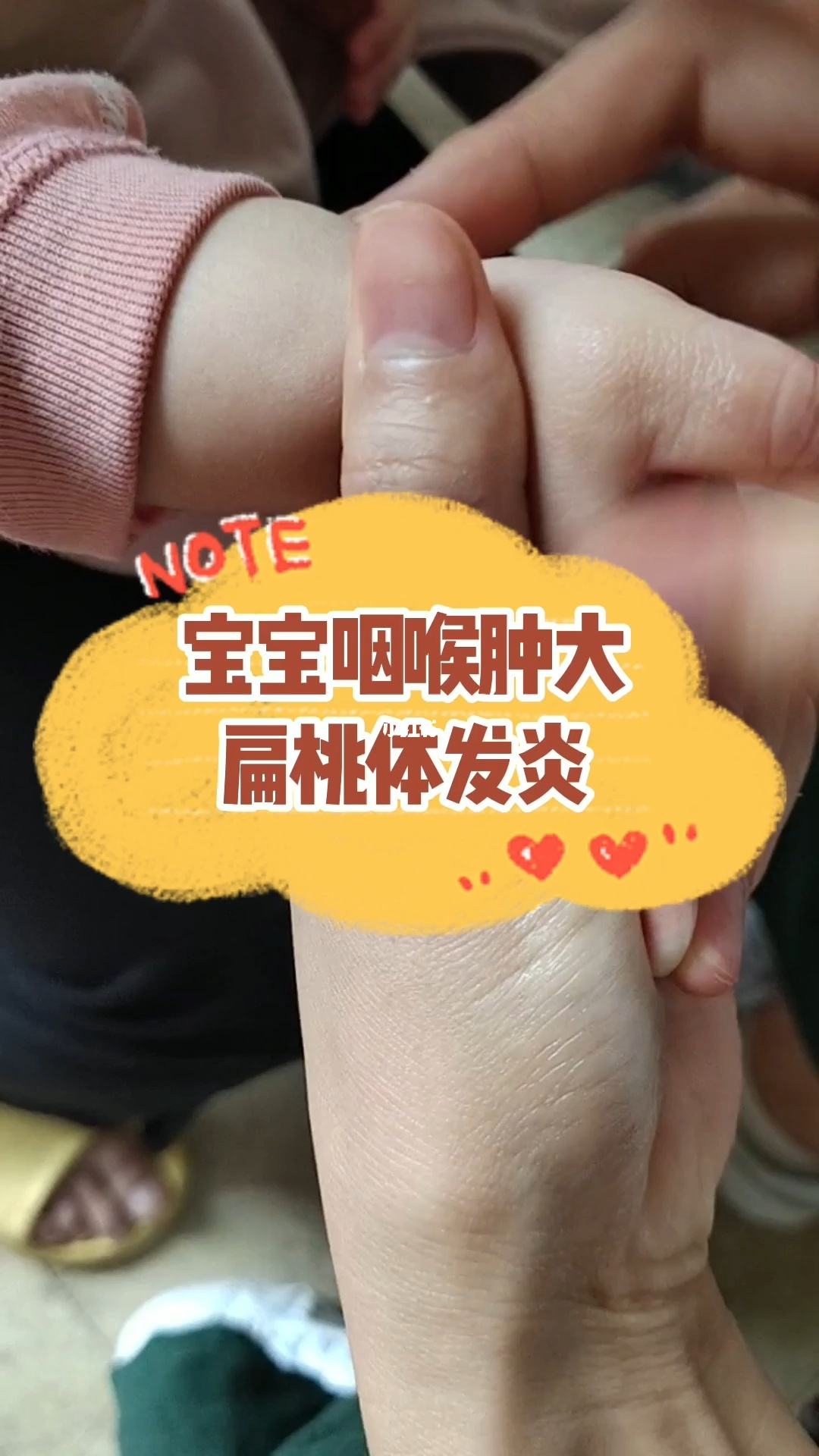 小孩经常扁桃体发炎该怎么预防(小孩经常扁桃体发炎该怎么预防扁桃体